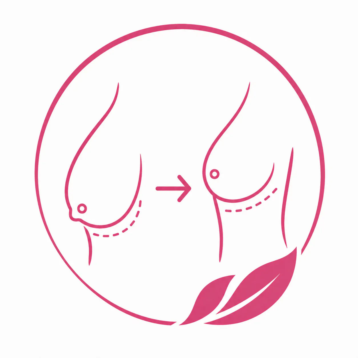 Птоз