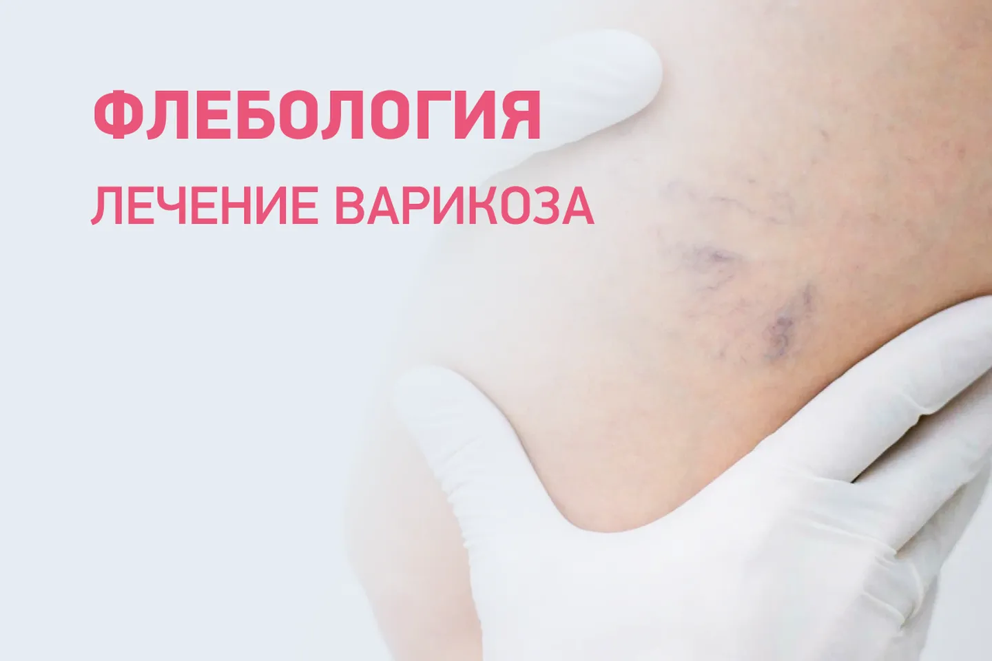 Флебология
