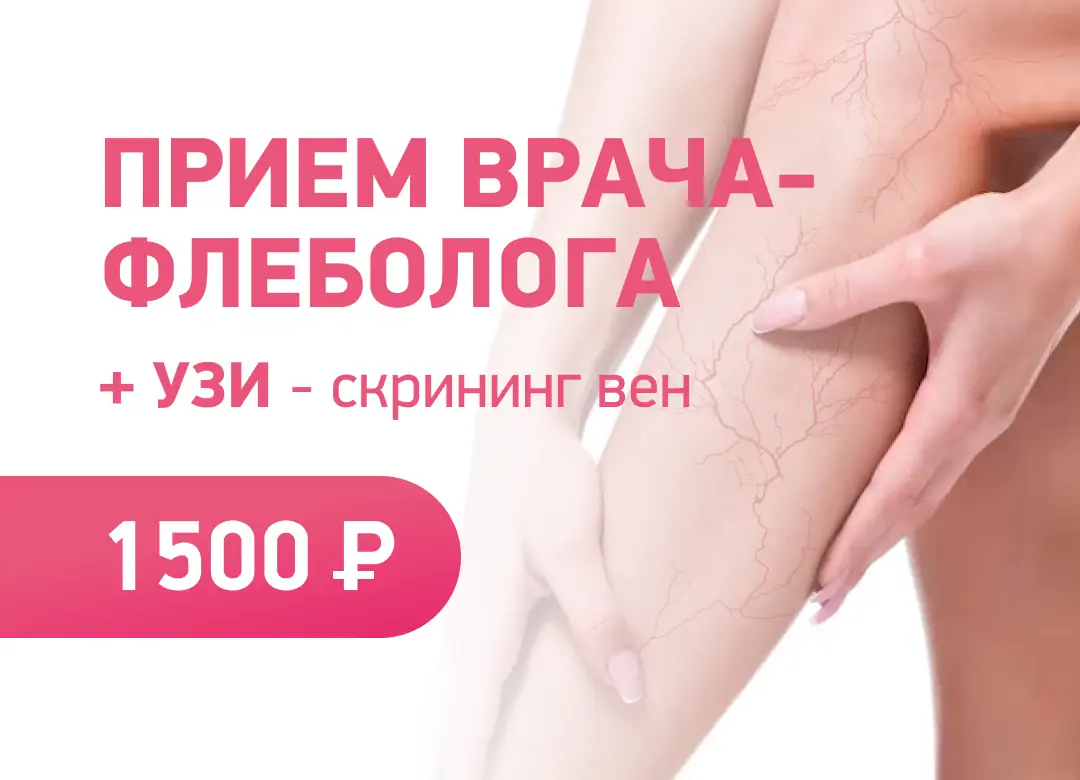 Акция Прием флеболога + УЗИ-скрининг вен ног за 1 500 ₽