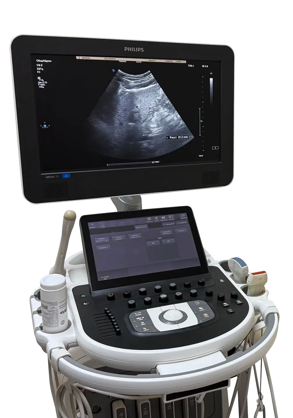 Ультразвуковая диагностическая система Philips Affiniti