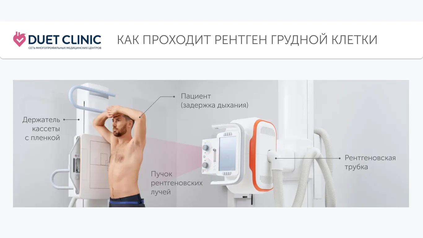 Как проходит рентген грудной клетки