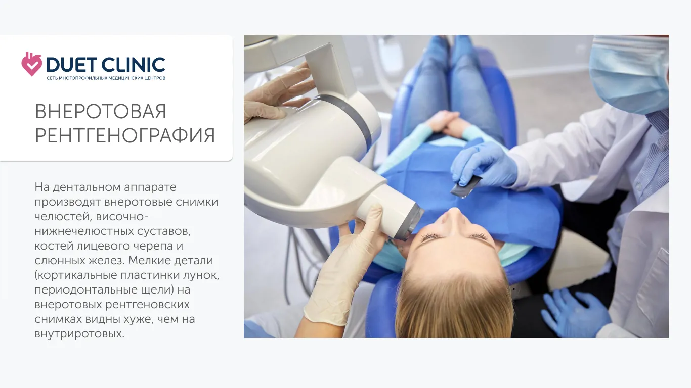 Внеротовая рентгенография