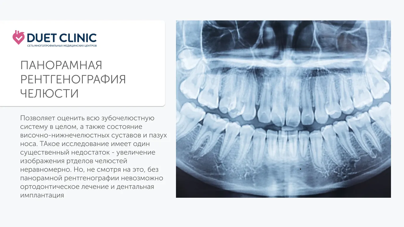 Панорамная рентгенография челюсти