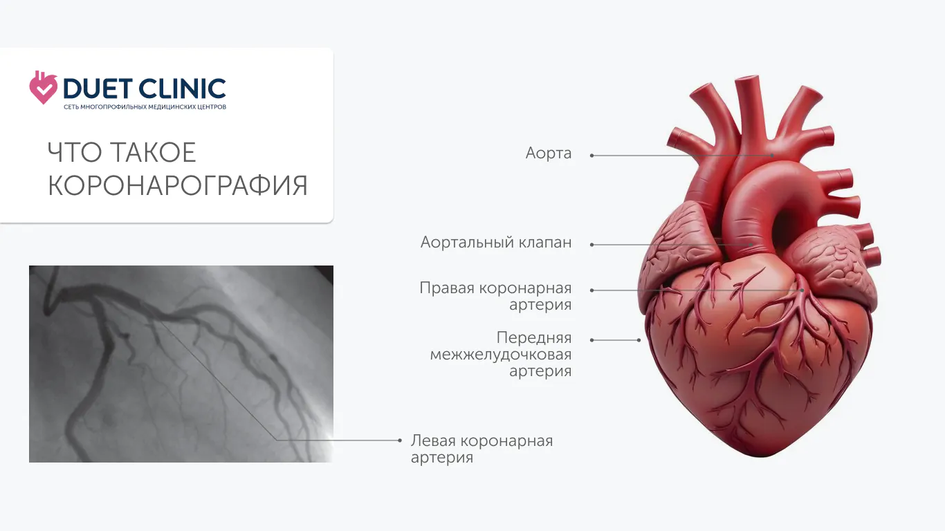 Что такое коронарография