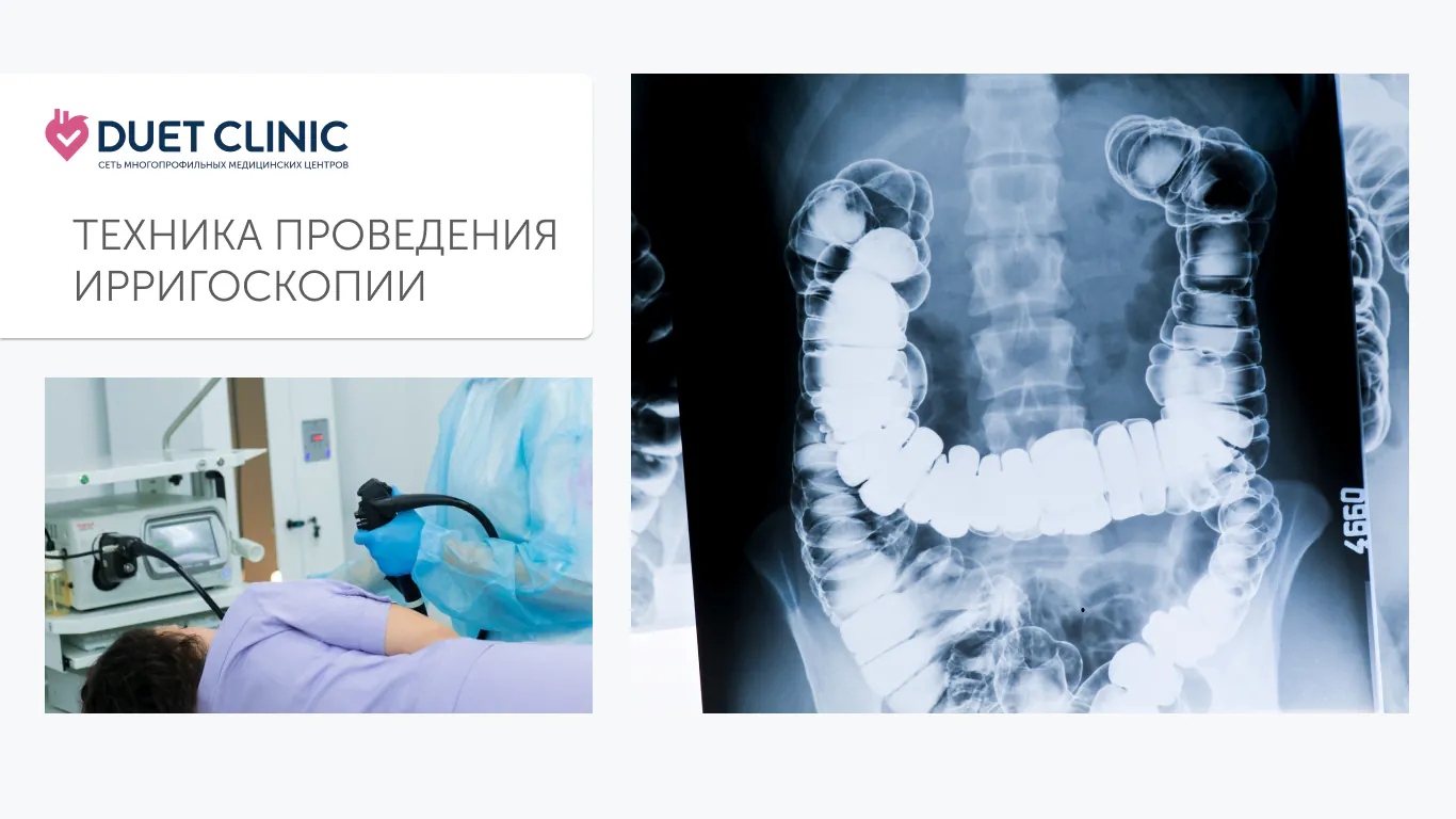 Техника проведения ирригоскопии