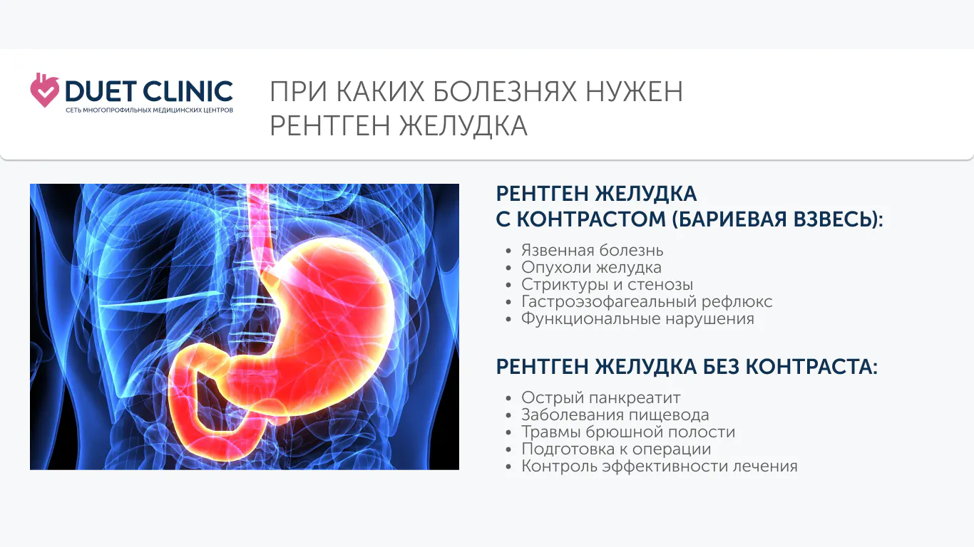 При каких болезнях нужен рентген желудка