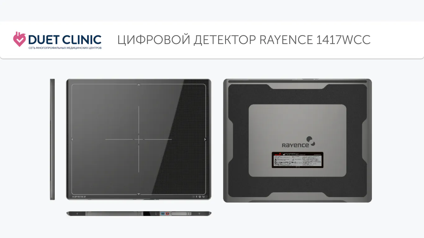 Цифровой детектор Rayence 1417WCC