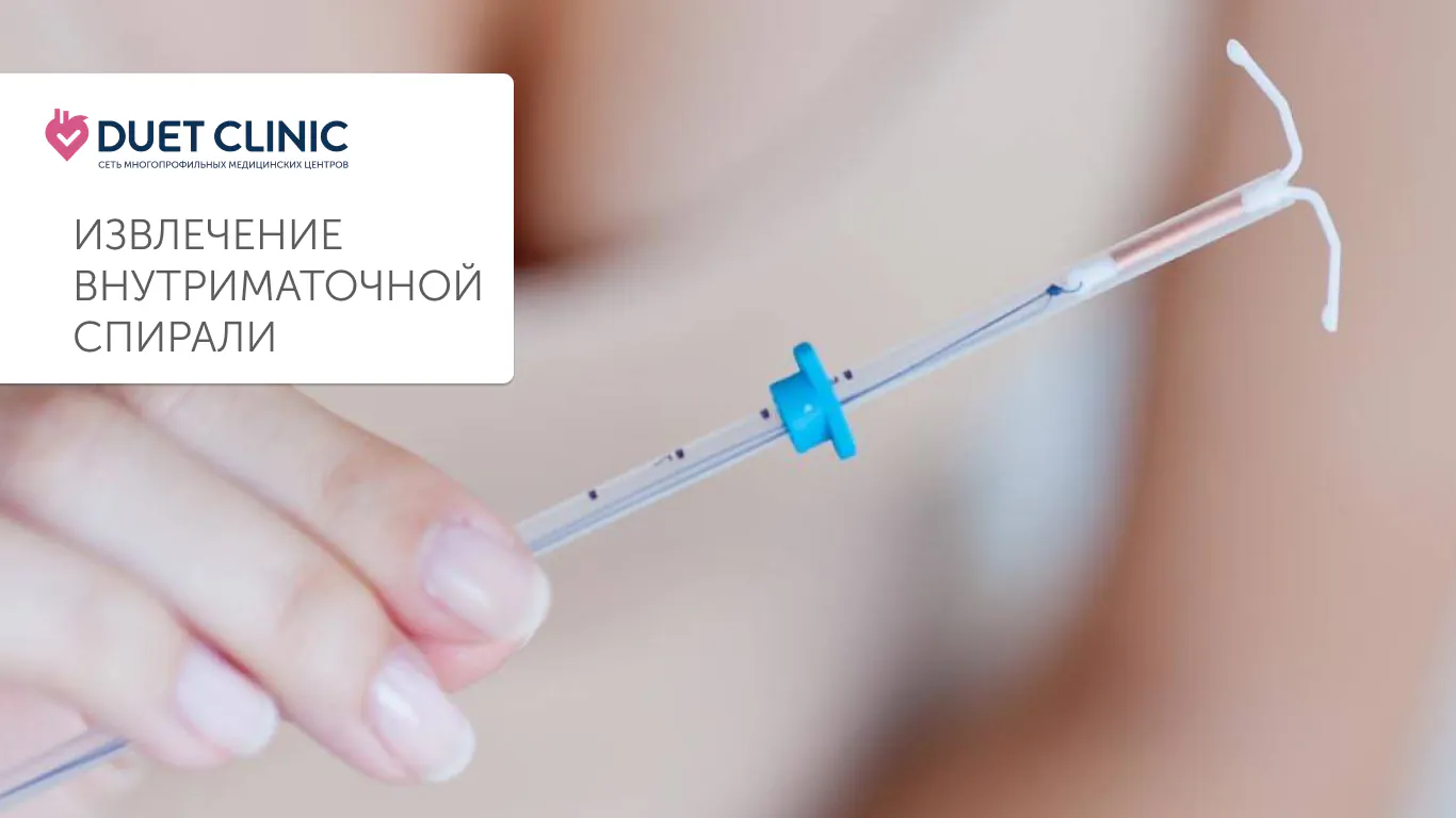 Извлечение внутриматочной спирали Извлечение внутриматочной спирали