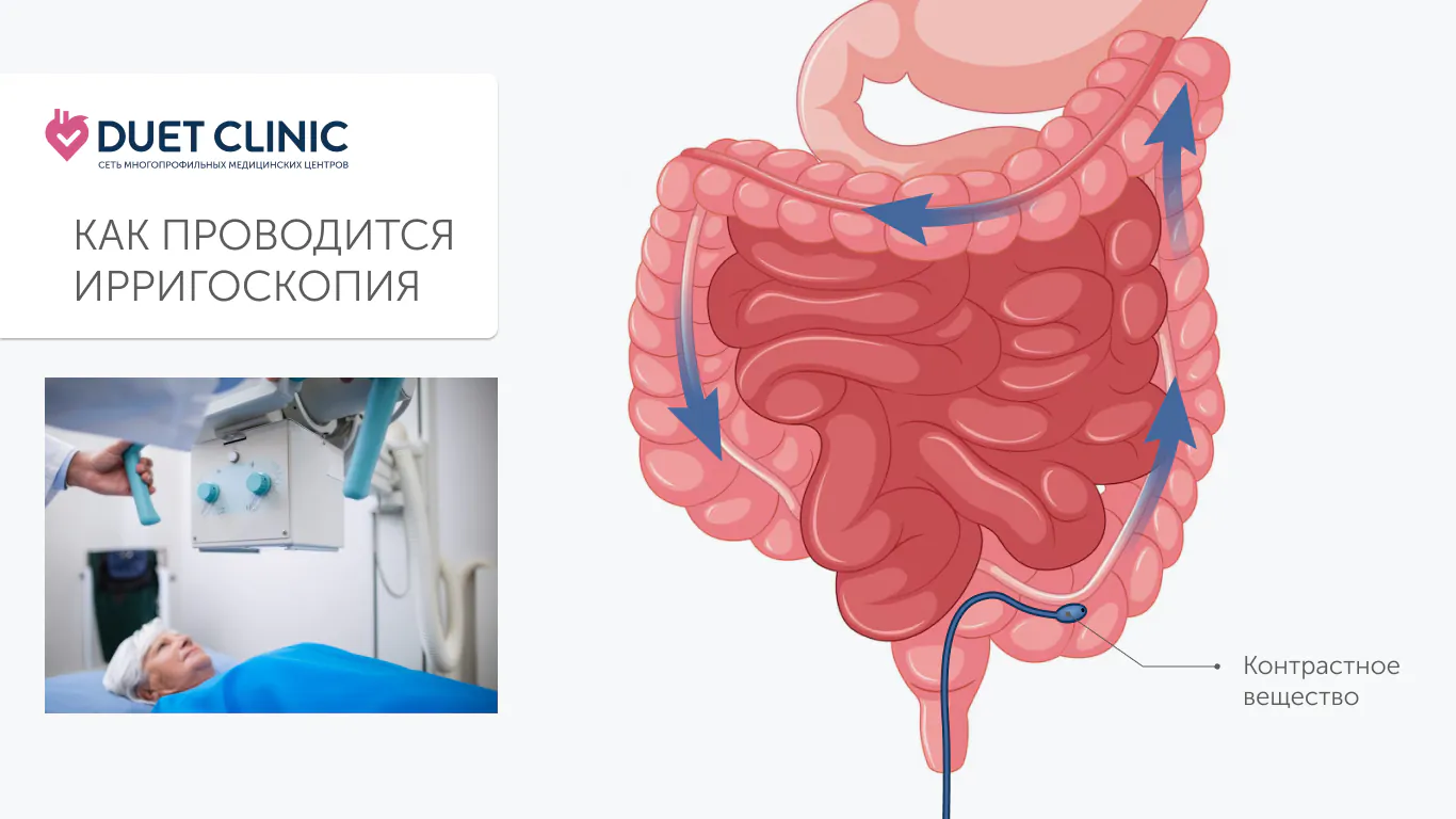 Как проводится ирригоскопия