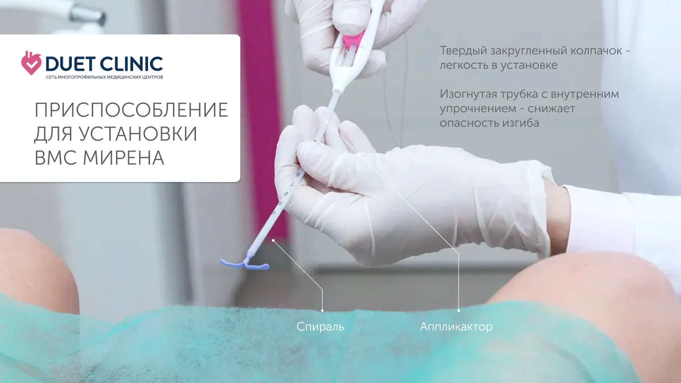 Приспособление для установки ВМС Мирена Приспособление для установки ВМС Мирена