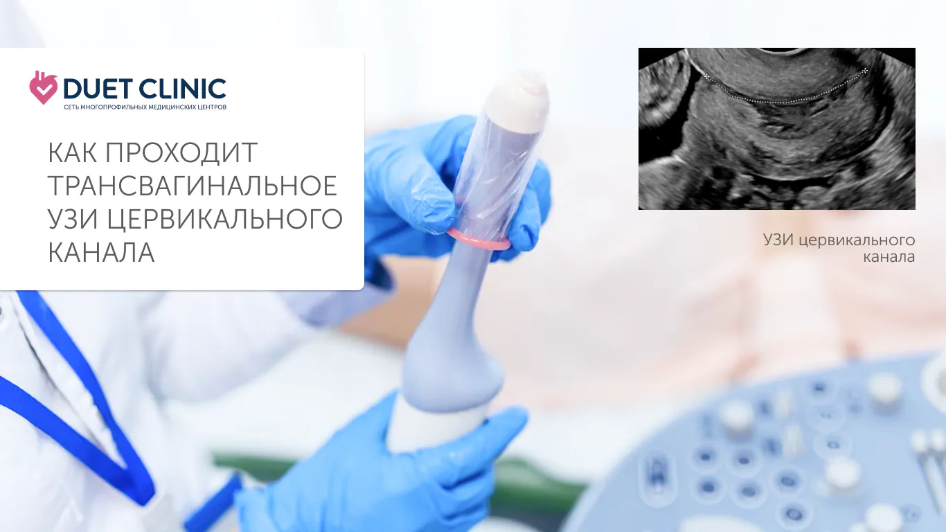 Как проходит трансвагинальное УЗИ цервикального канала