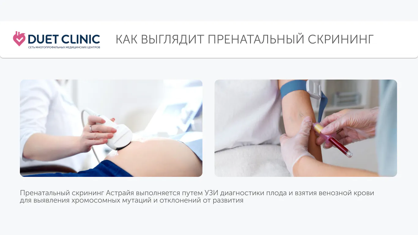 Как выглядит пренатальный скрининг