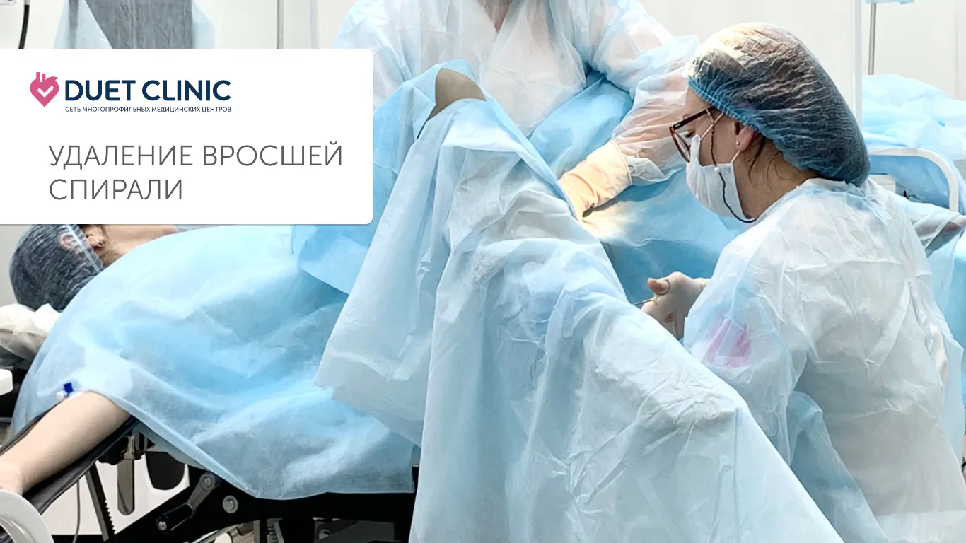 Удаление вросшей спирали Удаление вросшей спирали