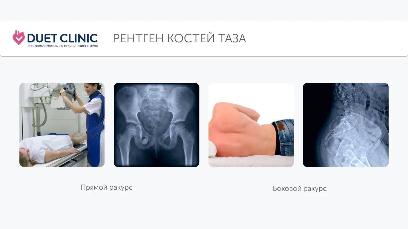 Рентген костей таза