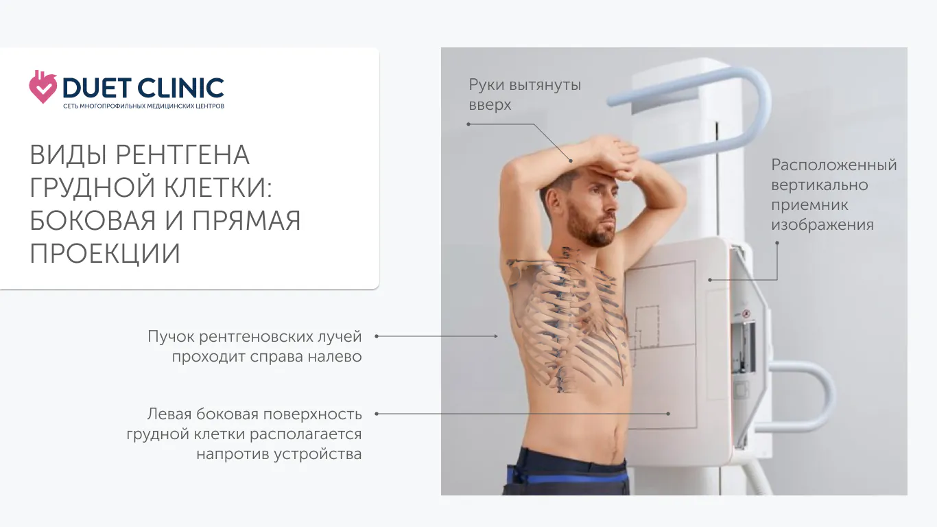 Виды рентгена грудной клетки, боковая и прямая проекции