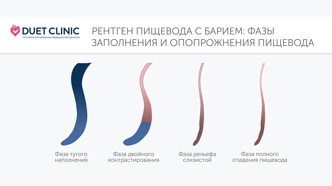 Рентген пищевода с барием. Фазы заполнения и опорожнения пищевода
