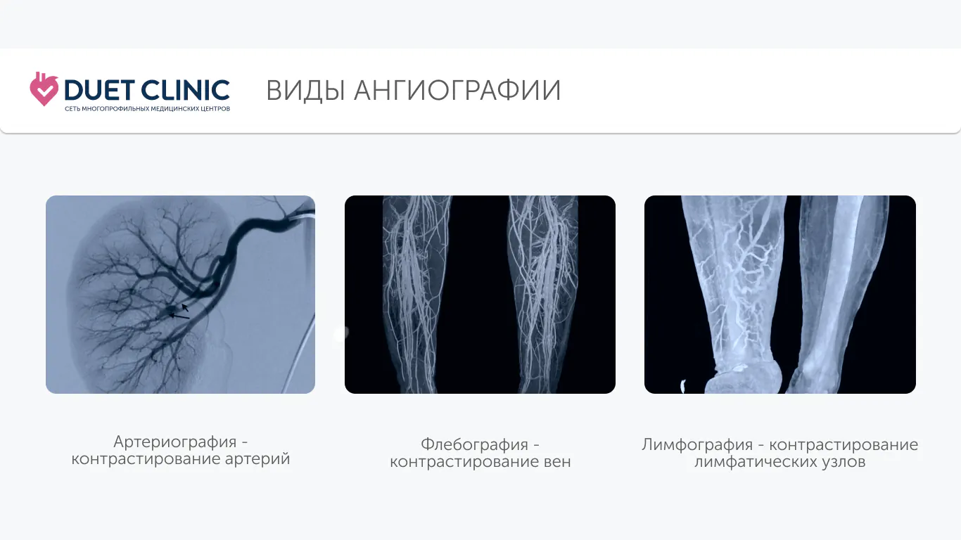 Виды ангиографии