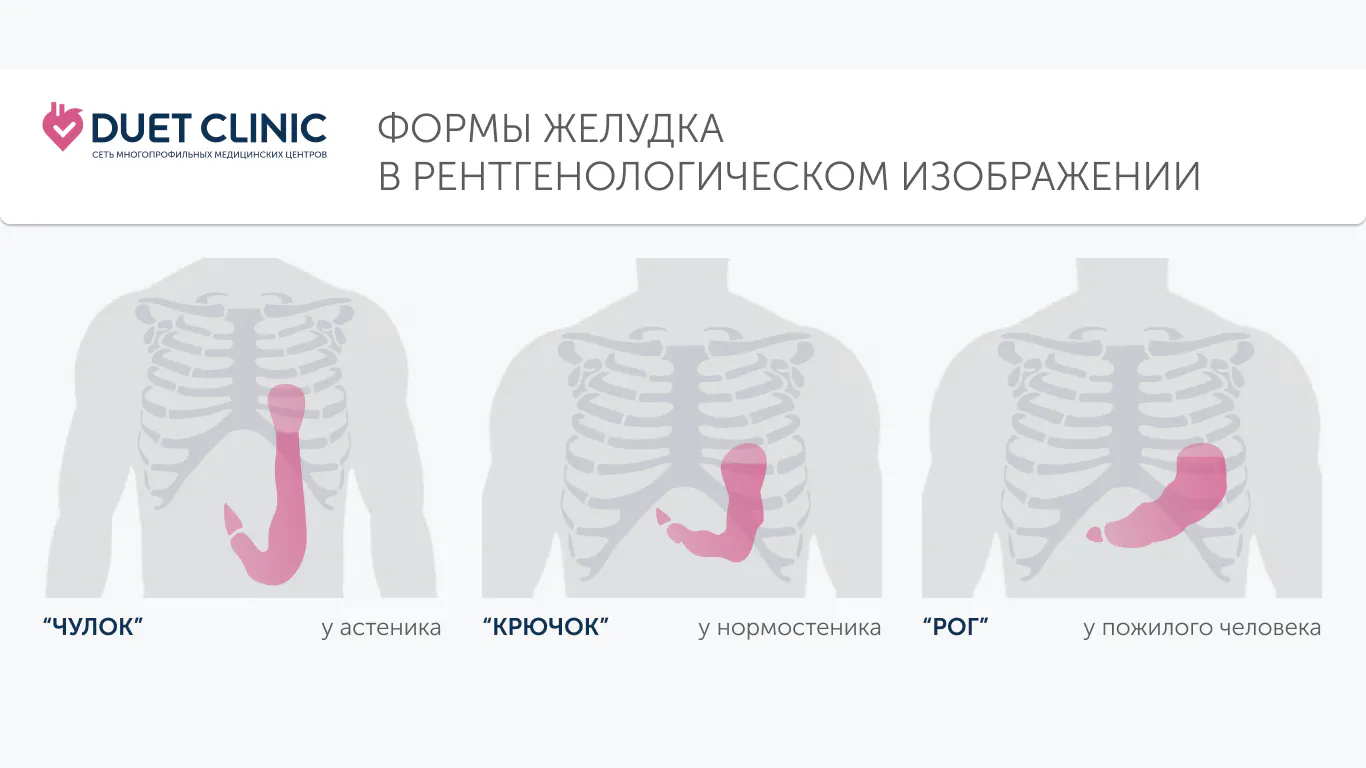 Формы желудка в рентгенологическом изображении