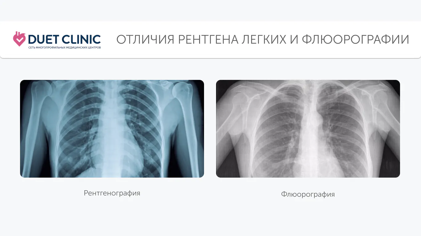 Отличия рентгена легких и флюорографии