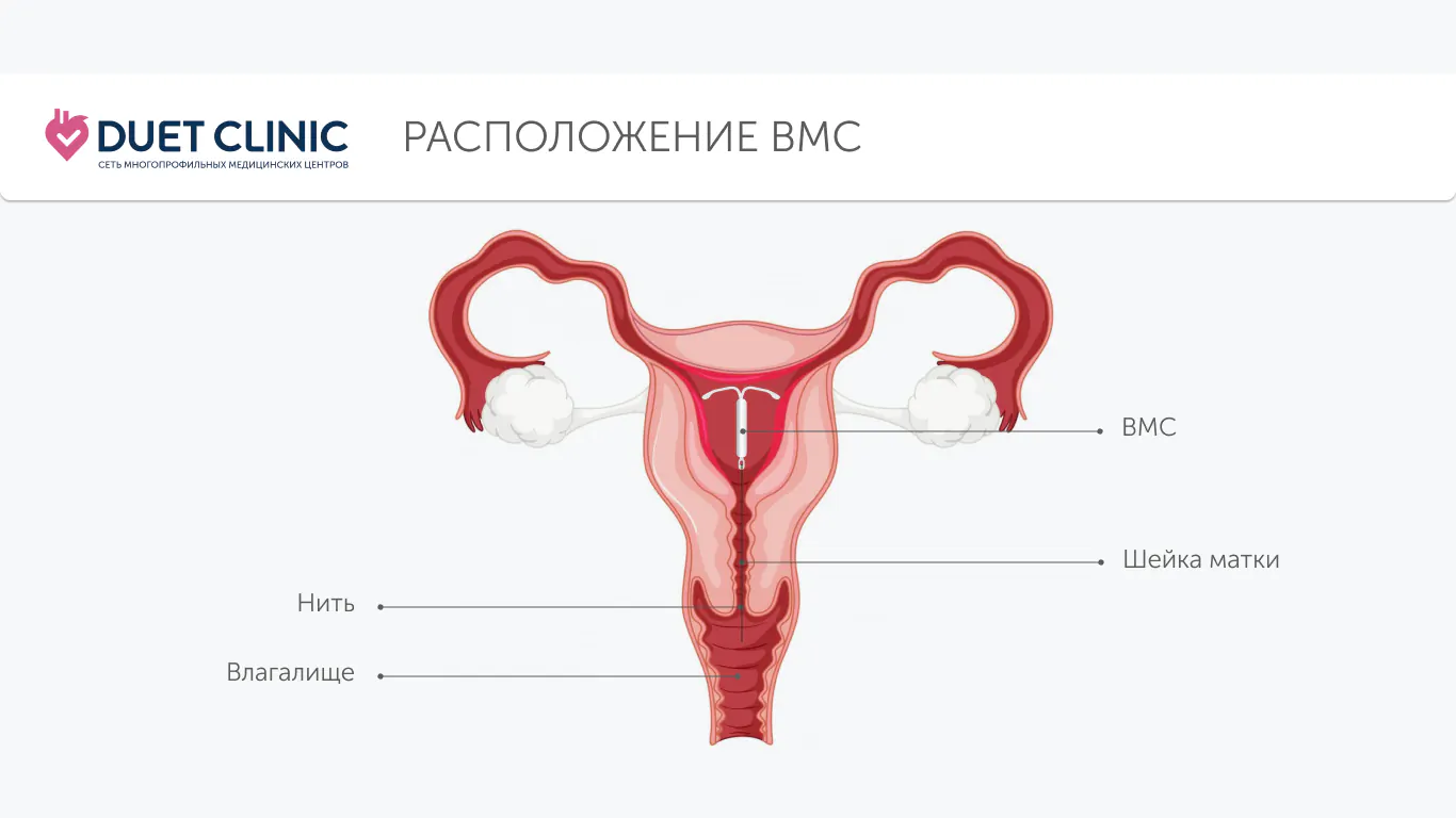 Расположение ВМС Расположение ВМС