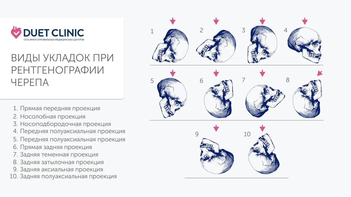 Виды укладок при рентгенографии черепа схема