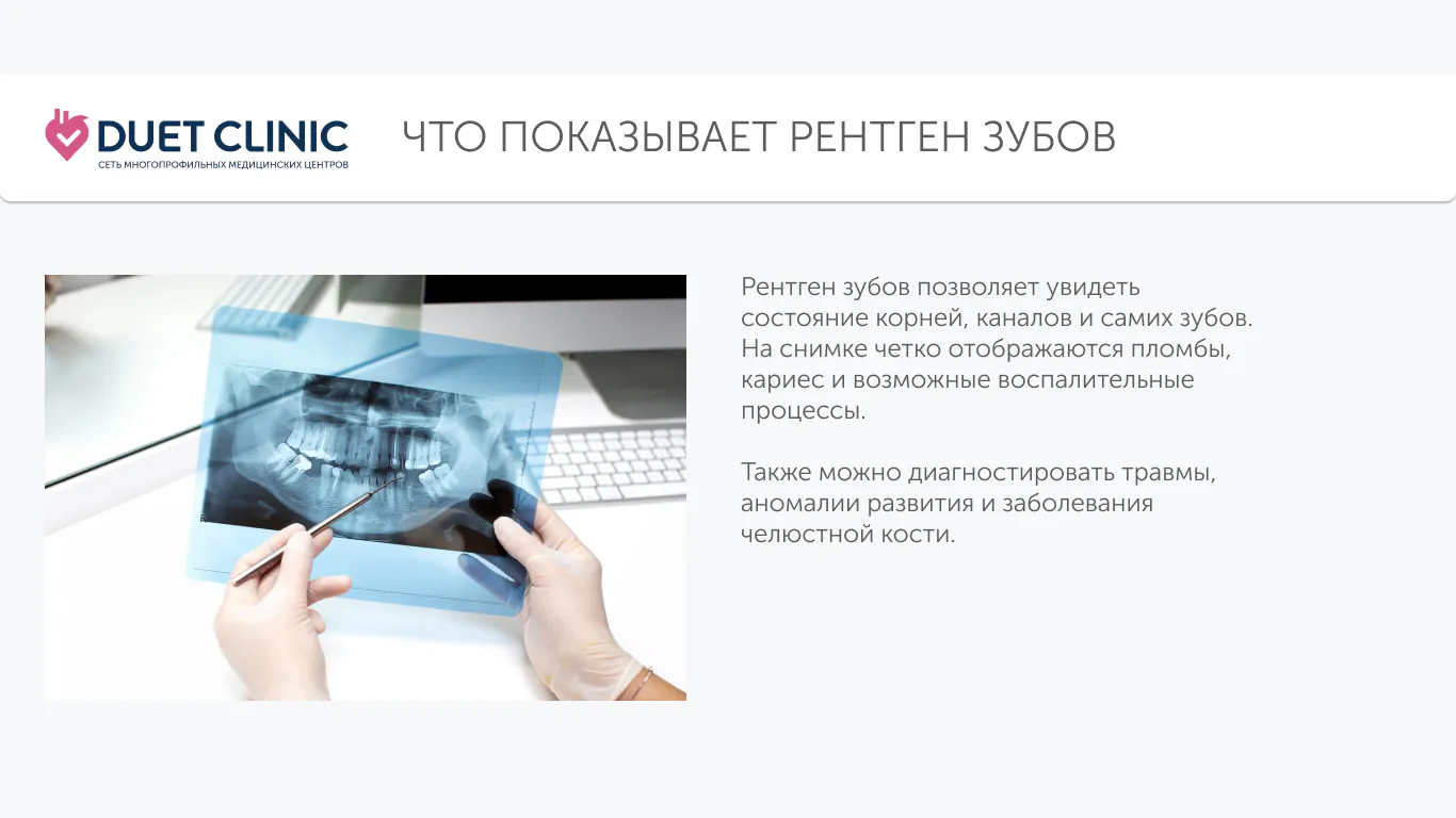 Что показывает рентген зубов